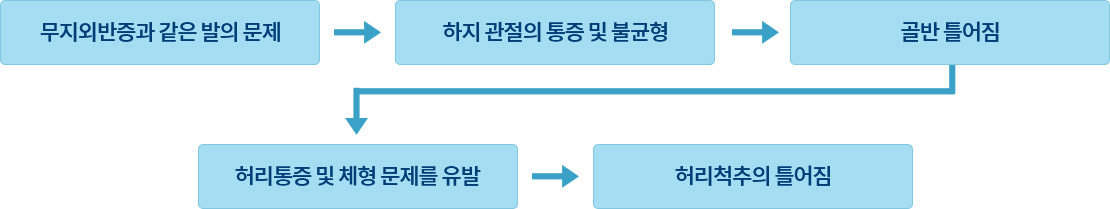 무지외반증 치료 이유 도표입니다