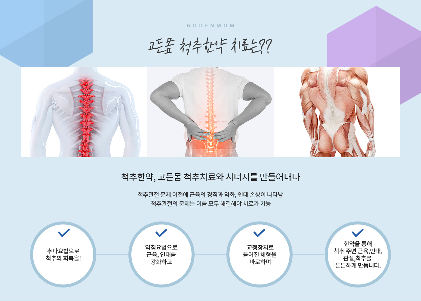 고든몸 척추한약 치료 이미지